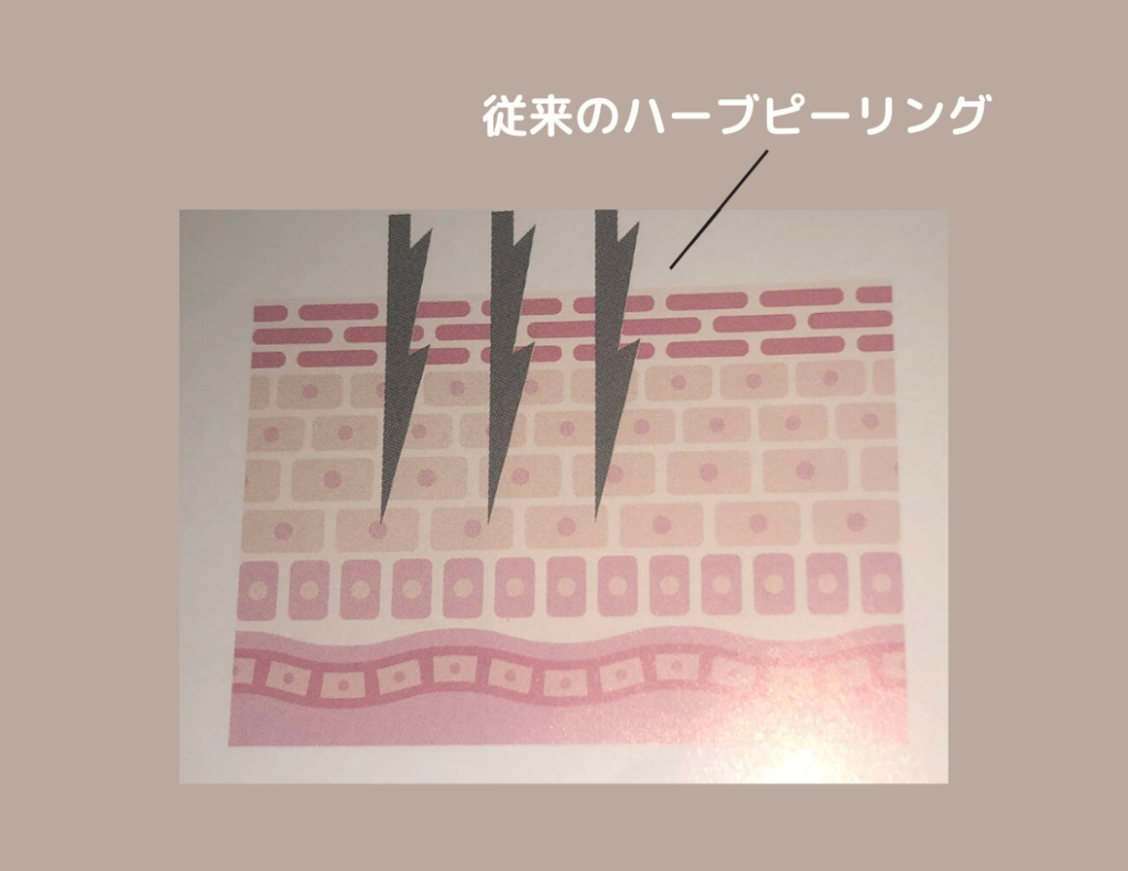 従来のハーブピーリング棘状成分
